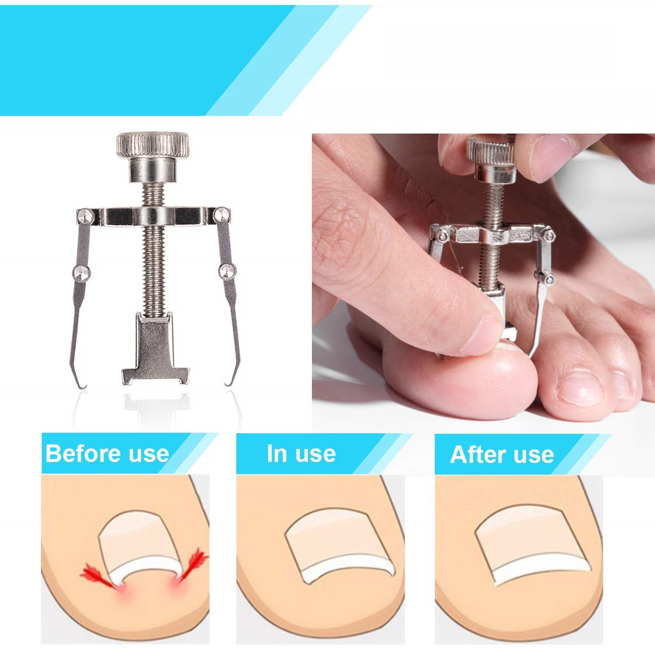 12-Piece Nail Clippers Set,Stainless Steel Professional Pedicure Women Man Manicure Kit