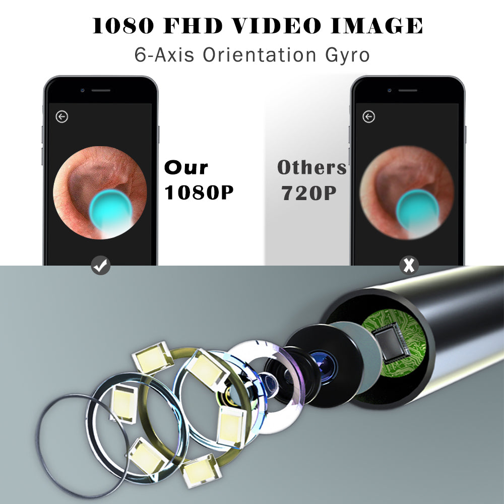 Ear Wax Removal, Endoscope,1080P HD Earwax Remover Tool, Wireless Ear Wax Removal Endoscope, Ear Endoscope with LED Light 3.9mm